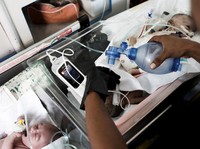 Tanda Kiamat Sudah Dekat, Makin Banyak Anak Lahir Prematur