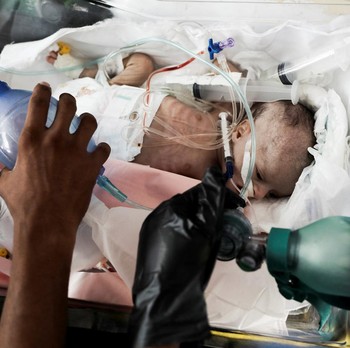 Pilu, Detik-Detik Bayi Prematur Dievakuasi dari Gaza Berselimut Selat