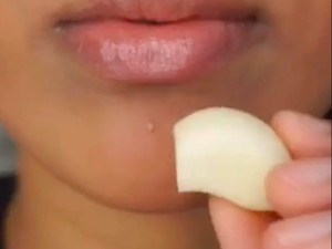 Viral di TikTok Tren Oles Bawang Putih ke Wajah, Ini Manfaatnya