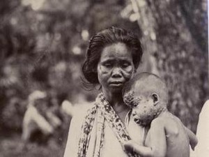 Horornya Cirebon Kala Diserang Wabah Patek di Era Hindia Belanda
