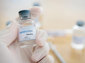Kata Dokter RSHS soal Upaya Mencegah Penyebaran Mpox