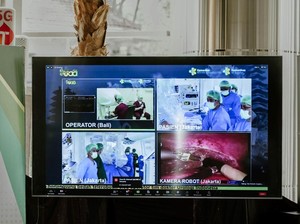 Bedah Robotik Jarak Jauh Jakarta Bali Sukses Dilakukan Berkat 5G
