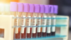 Mpox Bangkit Lagi? Singapura Catat 2 Kasus Baru Varian yang Lebih Ganas