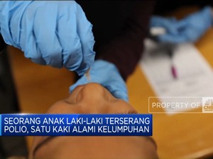 Video: Vaksinasi Polio Dimulai Di Gaza Targetkan 640 Ribu Anak