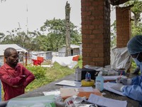 Potret Terbaru Wabah Mpox Menyebar di Negara Ini, Ribuan Orang Kena
