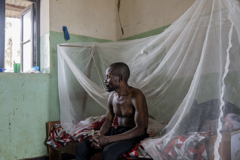 Congo Mpox A man suffering from mpox waits for treatment at the Kamituga General Hospital in South Kivu Congo, Wednesday, Sept. 4, 2024. (AP Photo/Moses Sawasawa)