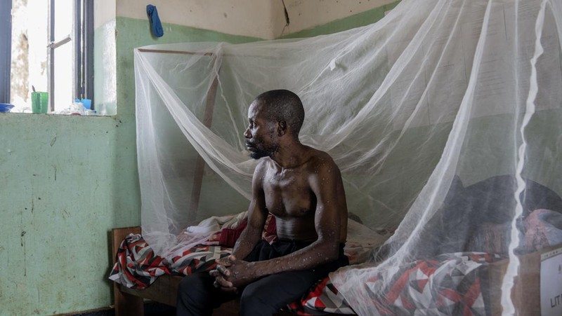 A man suffering from mpox waits for treatment at the Kamituga General Hospital in South Kivu Congo, Wednesday, Sept. 4, 2024. (AP Photo/Moses Sawasawa)