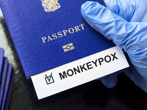 Fakta-fakta Kasus Pertama Mpox Varian Ganas Clade Ib di India