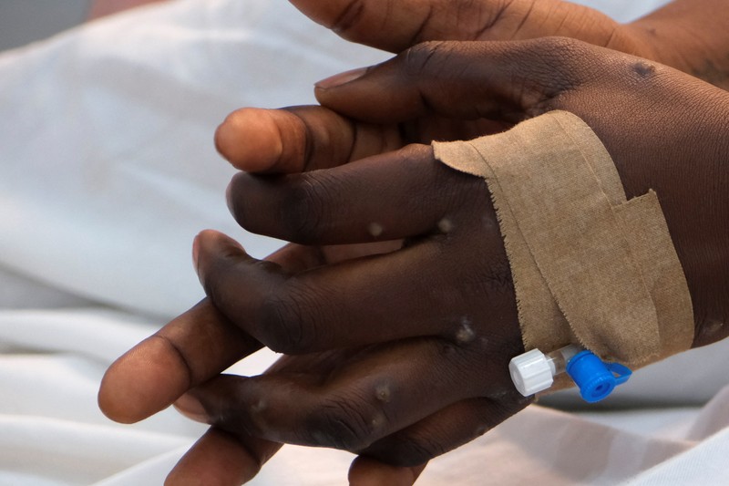 Pihak berwenang di Republik Demokratik Kongo kedatangan pertama vaksin cacar monyet di ibu kota Kinshasa, tiga minggu setelah Badan Kesehatan Dunia (WHO) menyatakan wabah mpox di 12 negara Afrika sebagai keadaan darurat global. (REUTERS/Justin Makangara)