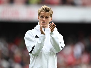 Odegaard Lega Cederanya Tak Separah Perkiraan