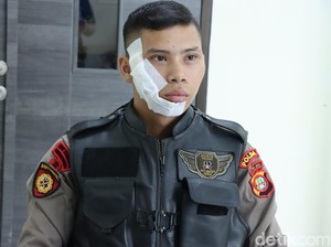 Detik-detik Anggota Patroli Disiram Air Keras Pelaku Tawuran di Jakbar
