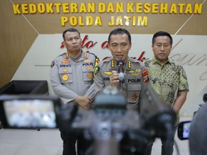 Kerangka Ditemukan di Surabaya Diduga Milik Lebih dari 2 Orang