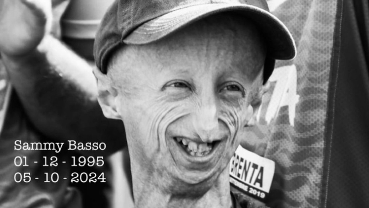 sammy-basso-instagramaiprosab_169 Mengenal Progeria, penyakit Sammy Basso yang menyebabkan penuaan dini