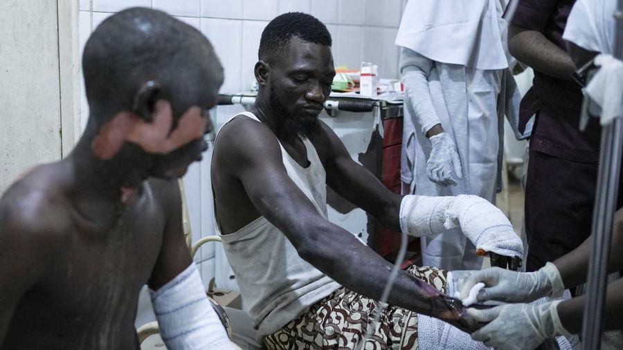 SENSITIVE MATERIAL. THIS IMAGE MAY OFFEND OR DISTURB A victim injured during a tanker explosion receives treatment at the intensive care unit of Aminu Kano Teaching Hospital, in Majia, Jigawa State, Nigeria, October 16, 2024.REUTERS/Alamin Mohammed