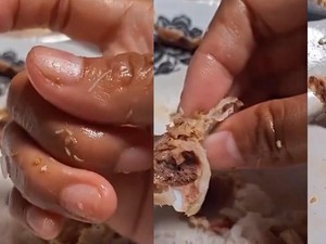 Tak Sengaja Menelan Belatung, Apa Efeknya? Begini Kata Dokter