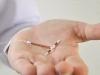 Benarkah Alat Kontrasepsi IUD Picu Kanker Payudara? Ini Faktanya