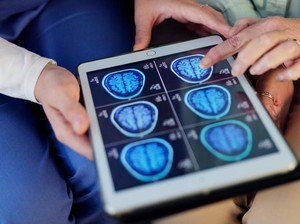 Dikira Gejala Kesemutan Biasa, Ternyata Wanita Ini Punya 10 Tumor di Otak