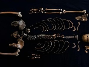 Tes DNA Ungkap Manusia Sumur Benar-benar Ada, Ini Kisahnya