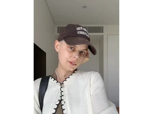 Bintang TikTok Umumkan Kematiannya dalam Video Terakhir Setelah Melawan Kanker