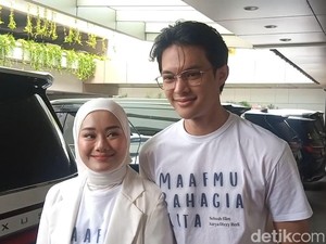 Rey Mbayang Operasi Hidung karena Gak Simetris Berefek saat Diving