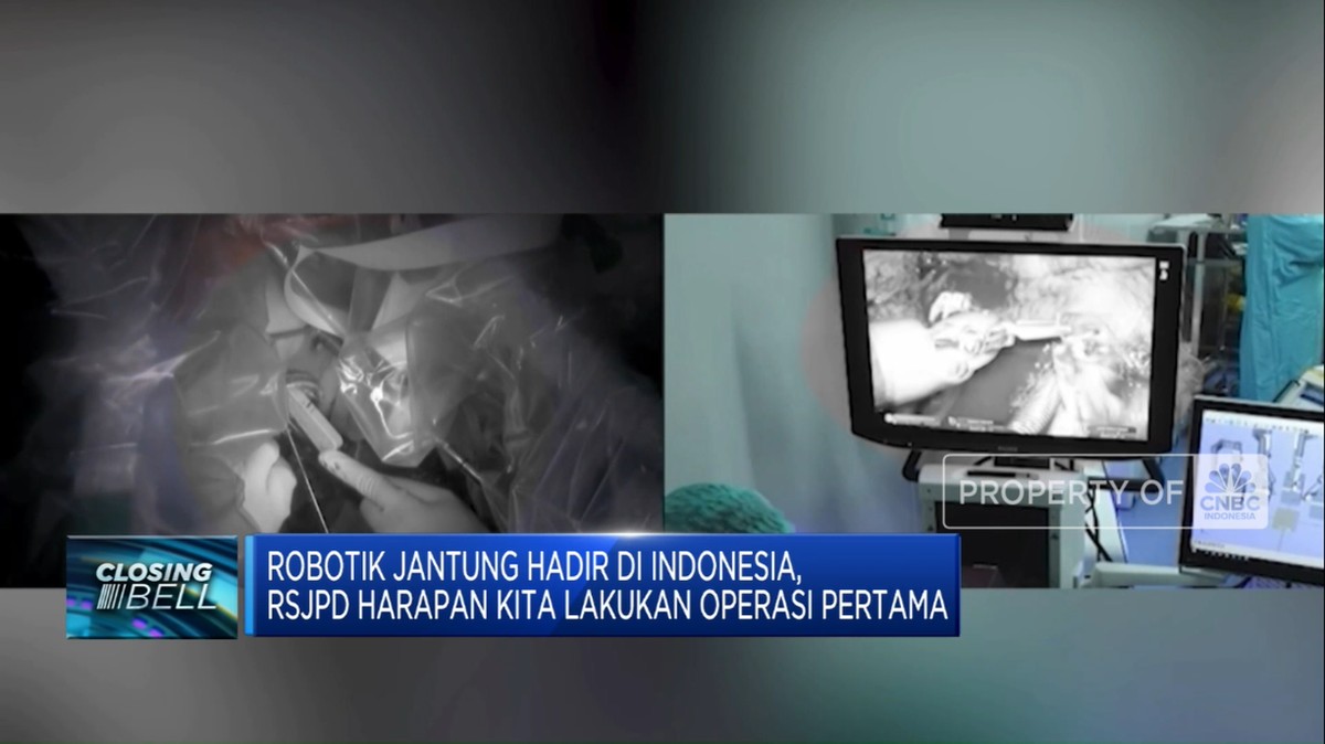 Revolusi Medis: RSJPD Harapan Kita Perkenalkan Operasi Jantung Pertama Menggunakan Robot!