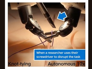 Robot Dilatih Prosedur Pembedahan, Benarkah Bisa Mengoperasi seperti Dokter Manusia?