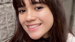 Most Pop: Foto Before-After Audi Marissa Perawatan Rp 42 Juta di Korea