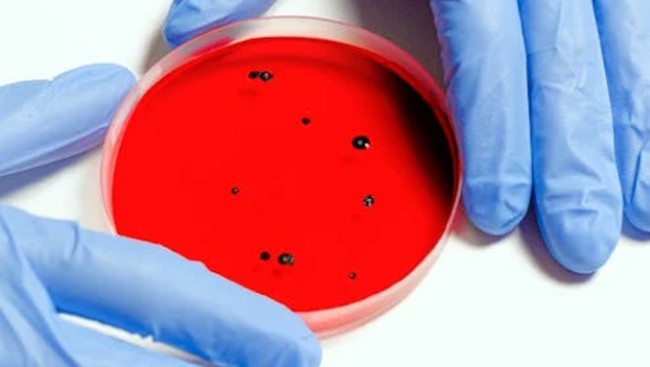 Awas! Virus Baru Guncang Dunia, Menyebar di Kapal Pesiar