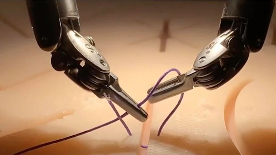 Robot da Vinci yang dilatih berdasarkan model tim tersebut melakukan prosedur pembedahan yang sama terampilnya dengan dokter manusia.
Dok: JOHNS HOPKINS UNIVERSITY