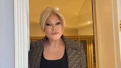 Sosialita Ratu Oplas Catwoman Jocelyne Wildenstein Meninggal saat Tidur Siang
