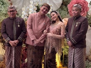 Perubahan Besar Rizky Febian dan Wejangan Sule