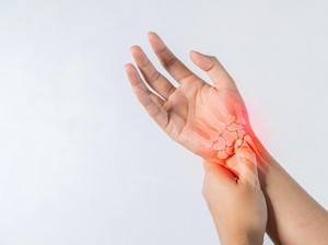 Kerap Dijuluki Silent Disease, Begini Cara Cegah Osteoporosis Sejak Dini