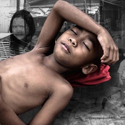 Makan Bergizi Gratis sudah dimulai, Seburuk Apa Krisis Gizi Anak RI?