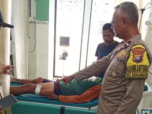 Kuli Bangunan di Bojonegoro Tertembak Senapan Angin