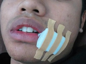 Jebakan Benang Nilon di Jembatan Suramadu Makan Korban Pemotor