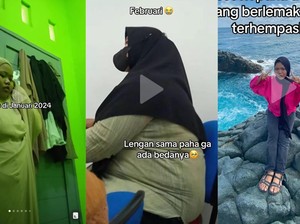 Viral Before Vs After Diet Wanita Mantan Obesitas Bikin Pangling! Sempat 100 Kg