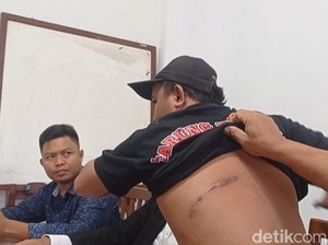 Cerita Korban Penganiayaan hingga Kasusnya Disorot Komisi III DPR
