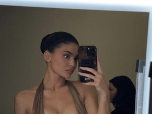Pria Lebih Suka Wanita dengan Bibir Alami Dibanding Tebal karena Filler
