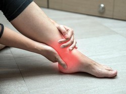 5 Gejala Asam Urat yang Muncul di Kaki, Salah Satunya Kemerahan