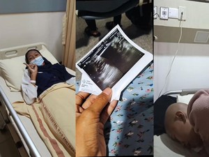 Pengakuan Wanita Purwakarta Kena Kanker Serviks di Usia 28, Punya Kebiasaan Ini