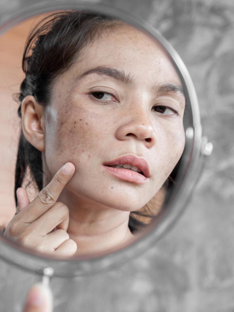 Dokter Kulit Ungkap Ciri-ciri Orang Akan Lebih Cepat Keriput