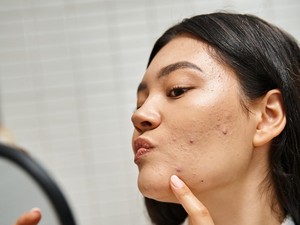 7 Ciri-Ciri Skincare Mengandung Merkuri yang Perlu Dihindari