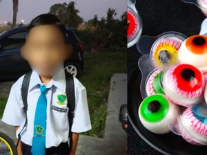Tersedak Permen Bola Mata, Bocah Ini Dilarikan ke ICU