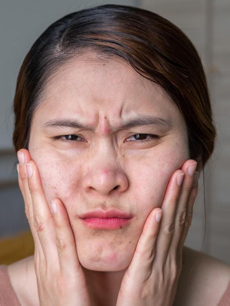 Rutinitas Skincare yang Cocok untuk Kulit Sensitif, Berminyak, dan Berjerawat