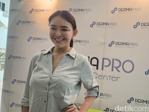 Perjuangan Amanda Manopo untuk Perawatan saat Sibuk Syuting