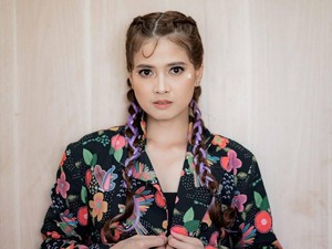 Chika Jessica Beberkan Kondisi Keponakan, Korban Salah Pukul di Demo Bandung