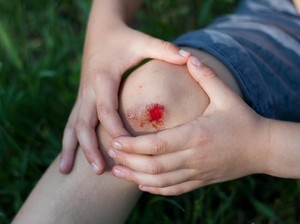 Luka di Tubuh Manusia Sembuh Lebih Lambat Dibanding Hewan, Ini Alasannya