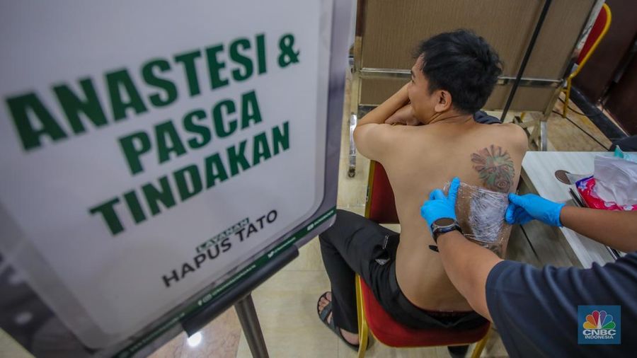 Peserta menjalani program hapus toto dengan mesin laser di Balaikota DKI Jakarta, Selasa (11/3/2025). (CNBC Indonesia/Faisal Rahman)