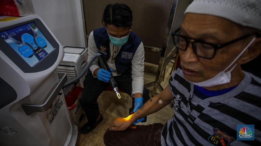 Peserta menjalani program hapus toto dengan mesin laser di Balaikota DKI Jakarta, Selasa (11/3/2025). (CNBC Indonesia/Faisal Rahman)