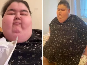 TikToker Mukbang Meninggal Dunia di Umur 24, Alami Komplikasi Akibat Obesitas